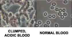 blood work